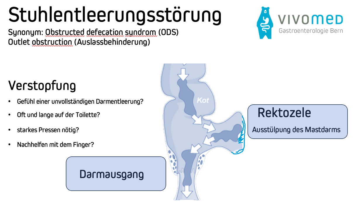Stuhlentleerungsstörung ODS Vivomed Gastroenterologie Bern
