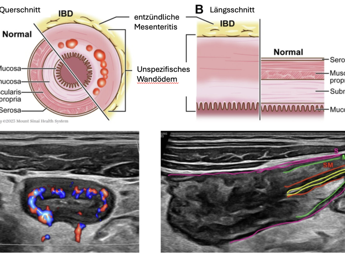 Vivomed Gastroenterologie Bern Ultraschall Darm